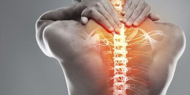 Medizinische Optionen für die Gebärmutterhals -Therapie der Gebärmutterhalsosteochondrose
